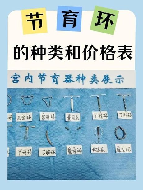 避孕环：现代避孕技术的革新