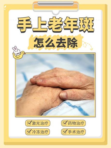 老人斑的祛除，老人斑祛除方法解析