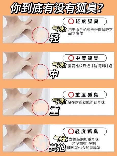 腋下狐臭的治疗方法