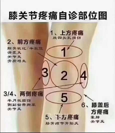 经常腿疼是怎么回事？