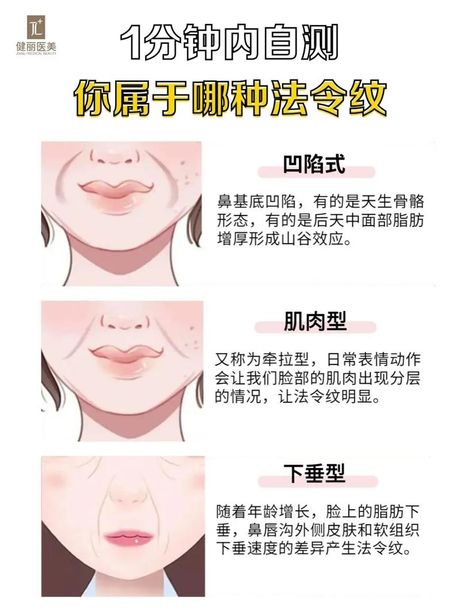 法令纹是哪里？
