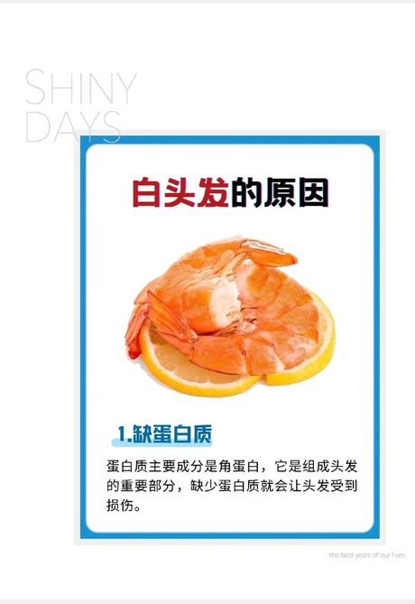 少白头的原因