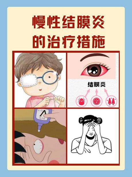 结膜炎怎么办?