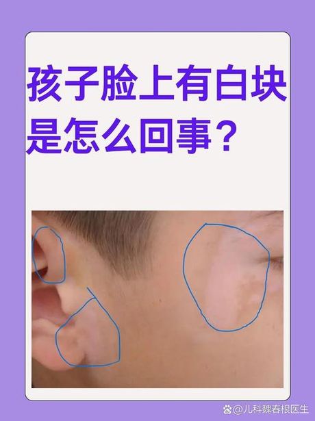 小白脸是什么意思