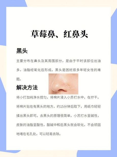 红鼻子的治疗与护理