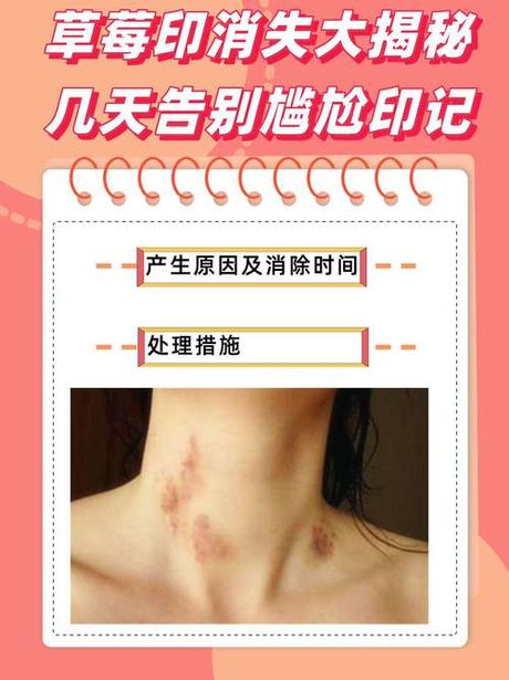 草莓印怎么弄：亲密印记的背后