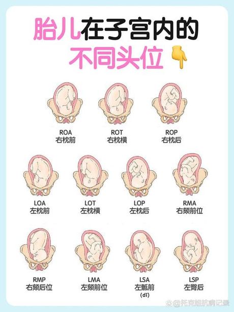 半入盆到全入盆：胎儿头部下降的过程