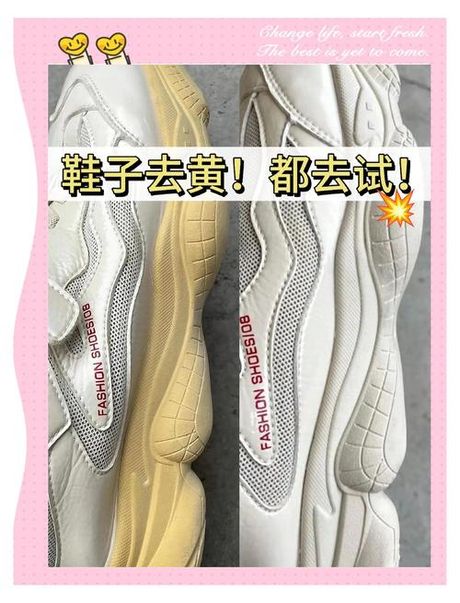 鞋变黄了怎么变白，如何使变黄的鞋子变白