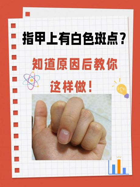 成年人指甲上有白点是怎么回事
