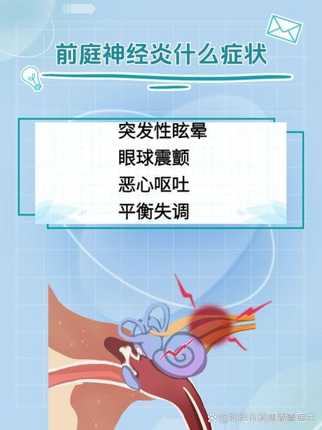 前庭神经元炎是什么病