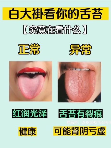 舌苔发白：原因及可能的影响