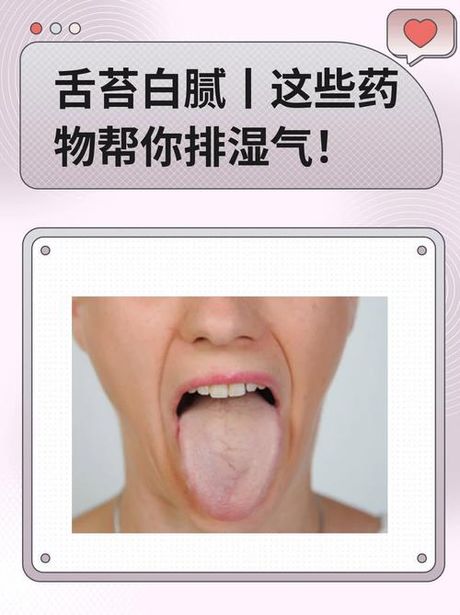 舌苔发白是怎么回事？应该吃什么药？