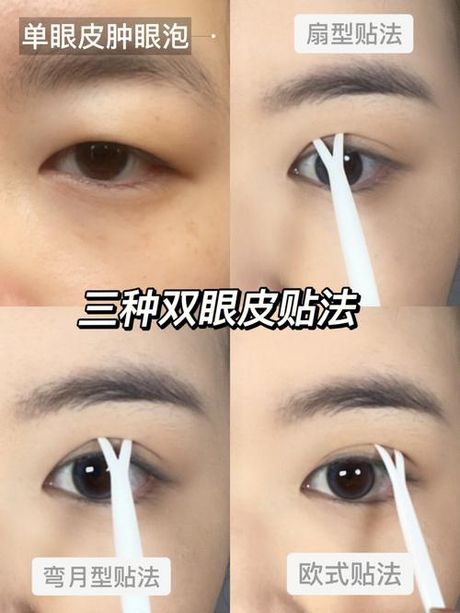 单眼皮如何贴双眼皮贴