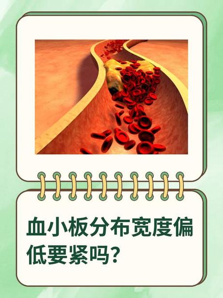 血小板体积分布宽度偏低：揭秘血液的秘密