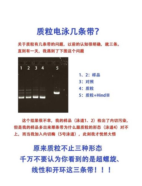 质粒电泳：原理、方法与应用