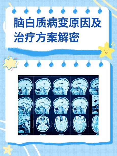 脑白质病：最新治疗进展与挑战