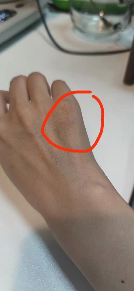狗咬了有点破皮怎么办：紧急处理与预防措施