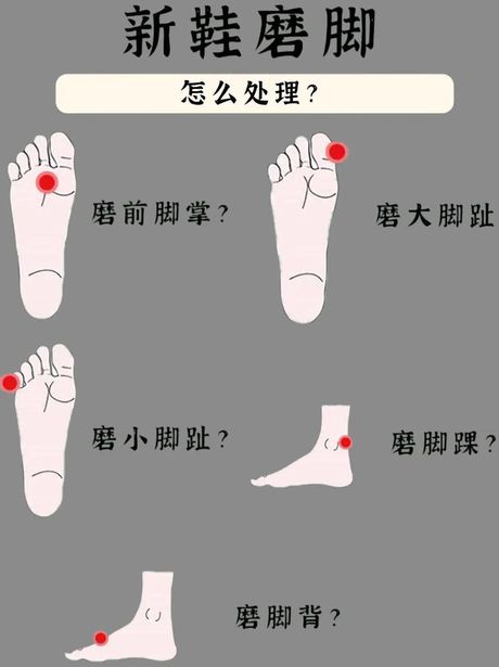 新鞋磨脚怎么办？