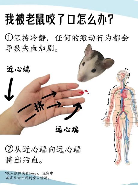 被老鼠咬了怎么办