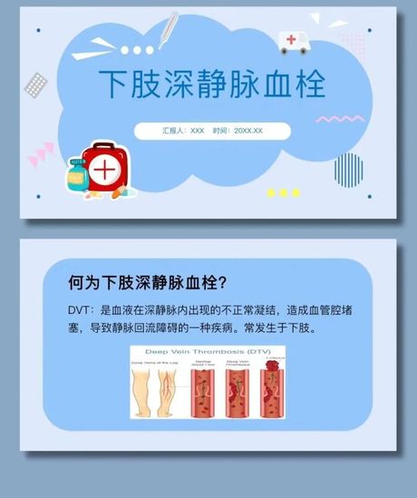 深静脉血栓形成（DVT）: 了解这种隐形的危险