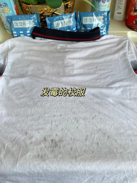衣服霉点怎么洗掉霉斑