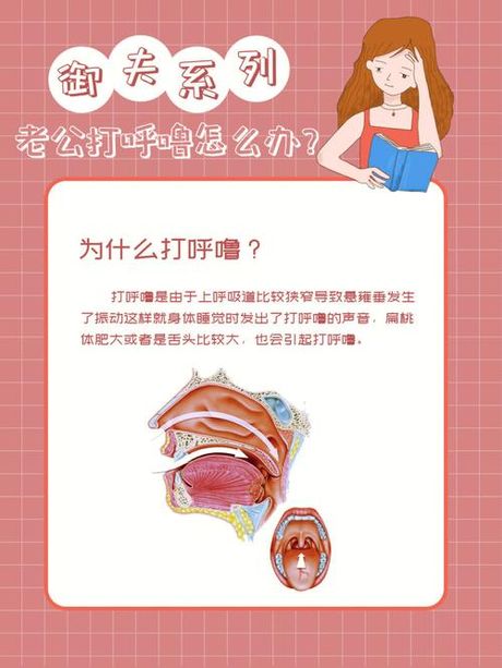 老公打呼噜怎么办？