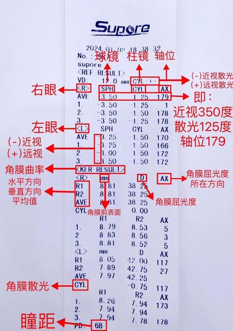 验光单解读指南