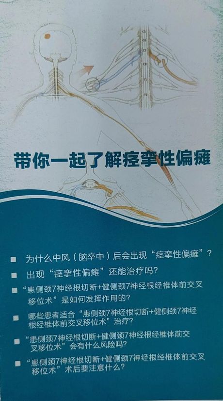 半身不遂：了解这种神经系统疾病