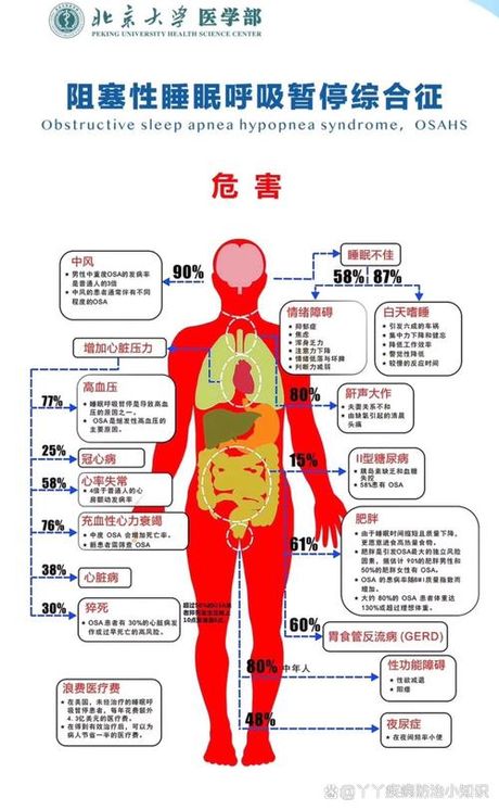 打呼噜的秘密：原因解析