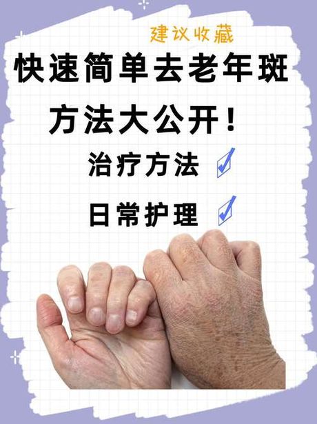 如何去除老年斑
