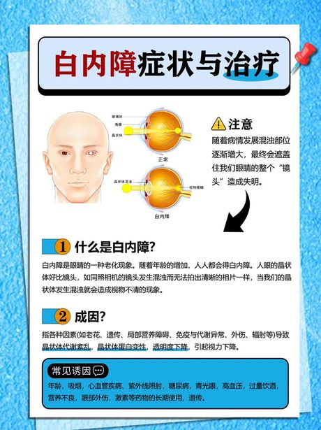 白内障的形成原因
