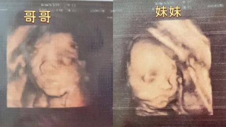 三维视角下的性别差异