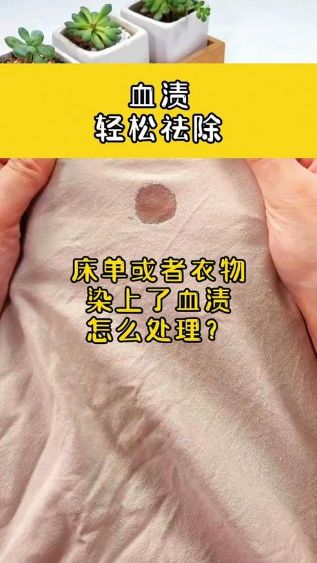 床单上的血迹怎么快速去除
