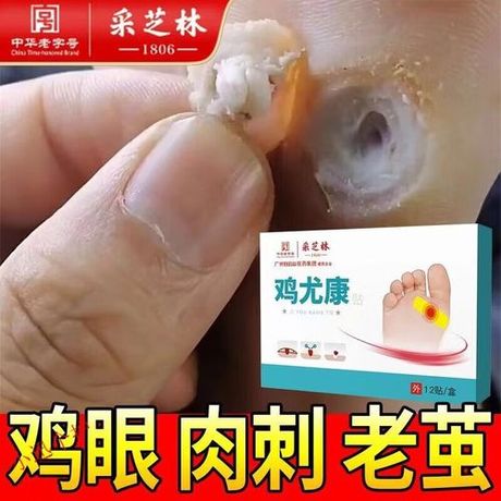 鸡眼膏要贴多久：揭秘足部护理的秘密