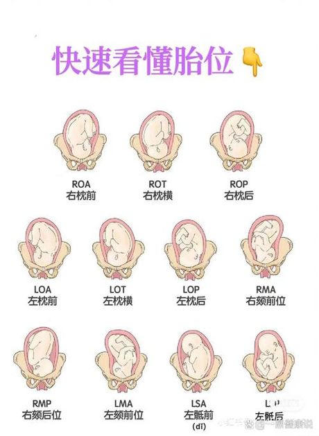 胎次是什么意思