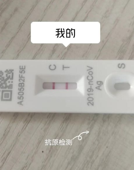 HIV试纸怎么看：了解自我检测的重要性