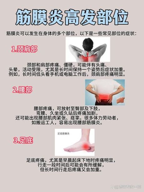 筋膜炎的症状，筋膜炎的症状解析