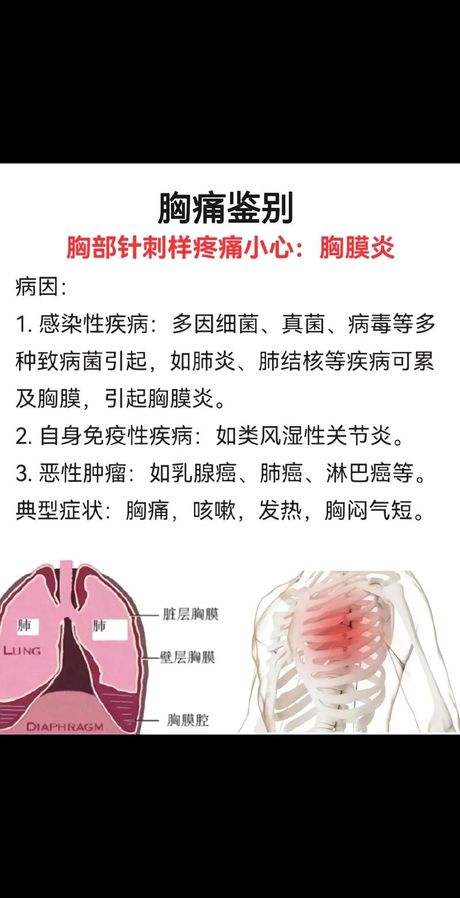 胸口中间疼是怎么回事？
