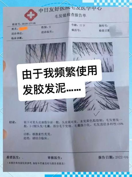 发胶怎么用，如何正确使用发胶