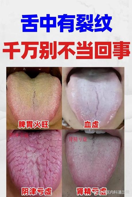 大人舌苔白是怎么回事