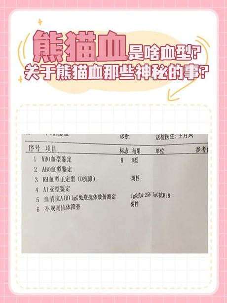 b型血为什么是熊猫血，B型血为什么是熊猫血