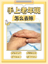 老人斑的祛除，老人斑祛除方法解析